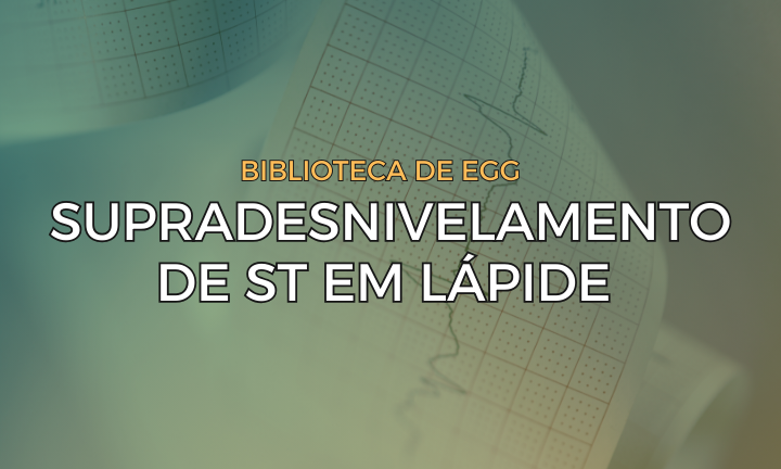 Leia mais sobre o artigo Padrão de Supradesnivelamento de ST em Lápide (Tombstone)