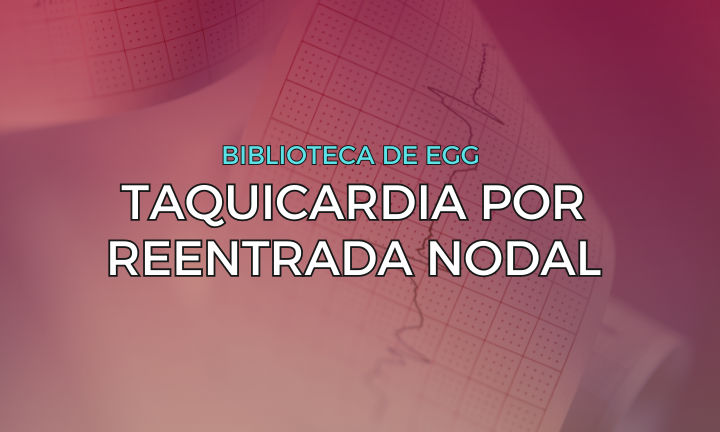 Leia mais sobre o artigo Taquicardia por Reentrada Nodal