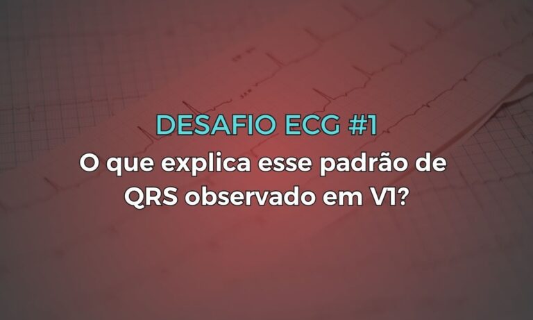 Leia mais sobre o artigo Desafio ECG #1: O que explica esse padrão de QRS observado em V1?