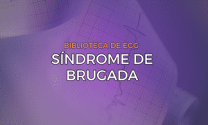 Leia mais sobre o artigo Síndrome de Brugada