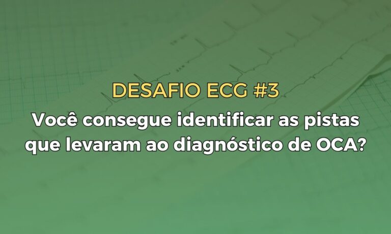 Leia mais sobre o artigo Desafio ECG #3: Você consegue identificar as pistas que levaram ao diagnóstico de OCA?