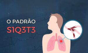 Leia mais sobre o artigo Padrão S1Q3T3: Qual a real importância desse achado?