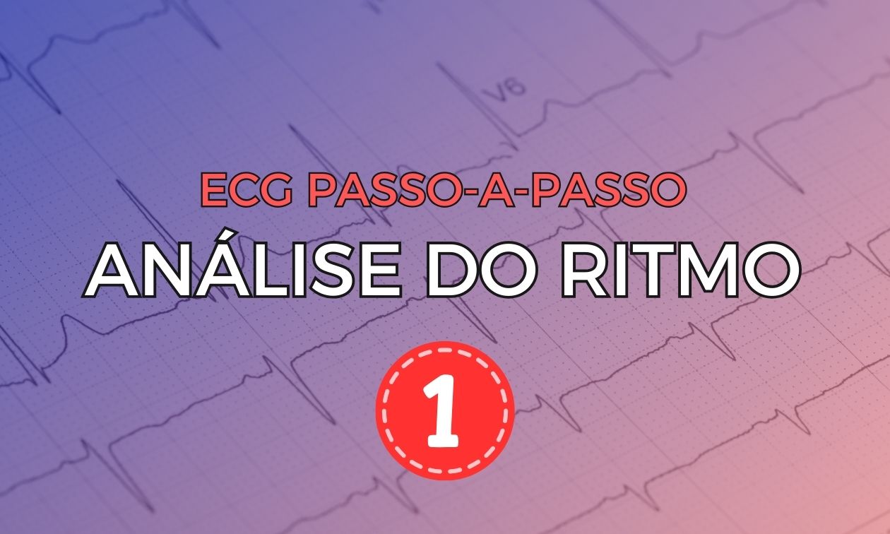 No momento, você está visualizando ECG Passo-a-Passo: Análise do Ritmo