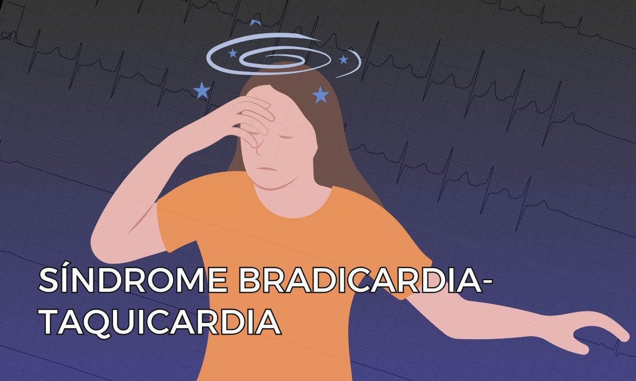 No momento, você está visualizando Síndrome Bradicardia-Taquicardia: Uma Visão Geral