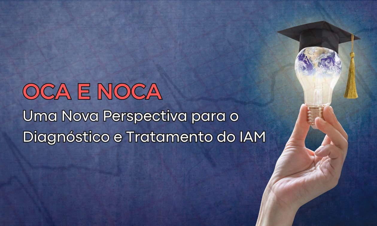 No momento, você está visualizando OCA e NOCA: Uma Nova Perspectiva para o Diagnóstico e Tratamento do Infarto Agudo do Miocárdio