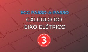 Leia mais sobre o artigo ECG Passo-a-Passo: Cálculo do Eixo Elétrico