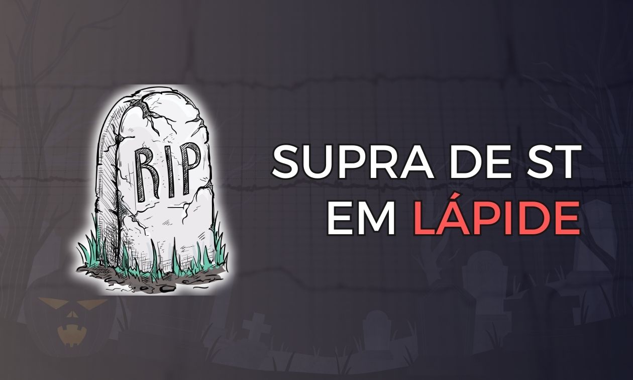 No momento, você está visualizando Supra de ST em Lápide: Características e Implicações Prognósticas