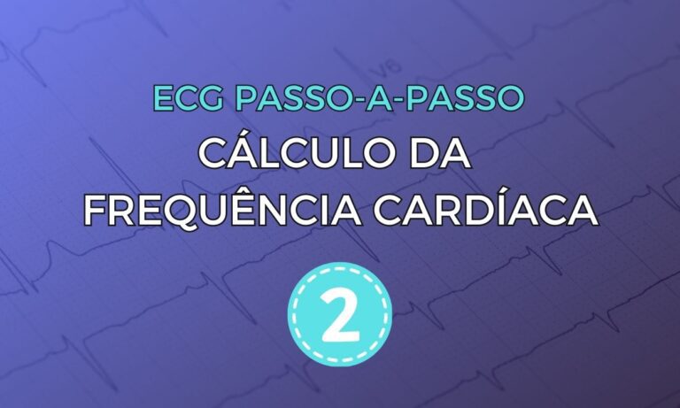 Leia mais sobre o artigo ECG Passo-a-Passo: Cálculo da Frequência Cardíaca