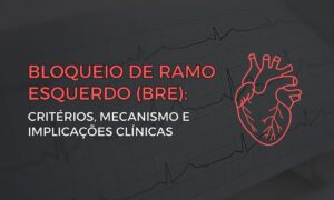 Leia mais sobre o artigo Bloqueio de Ramo Esquerdo: Critérios, Mecanismo e Implicações Clínicas