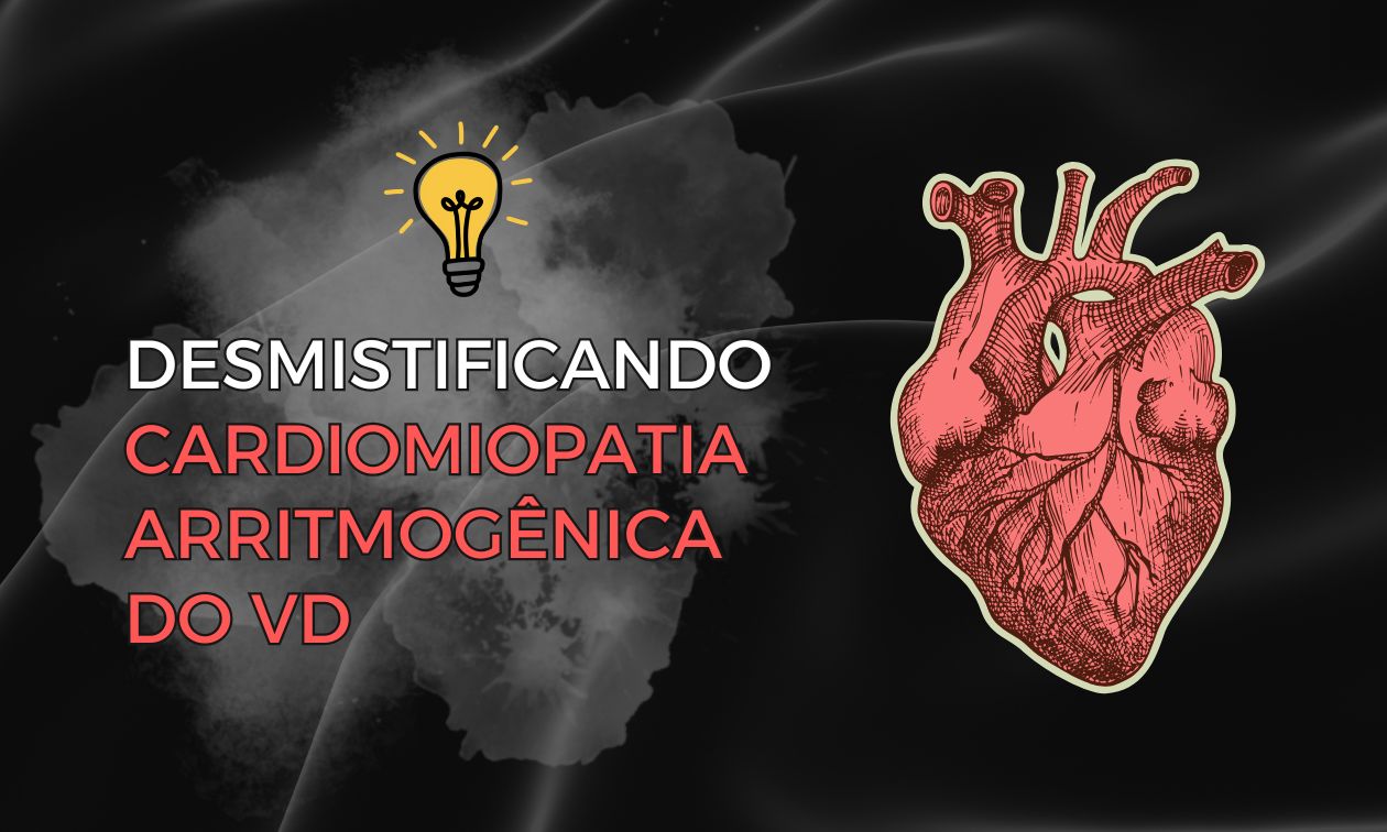 No momento, você está visualizando Desmistificando a Cardiomiopatia Arritmogênica do Ventrículo Direito