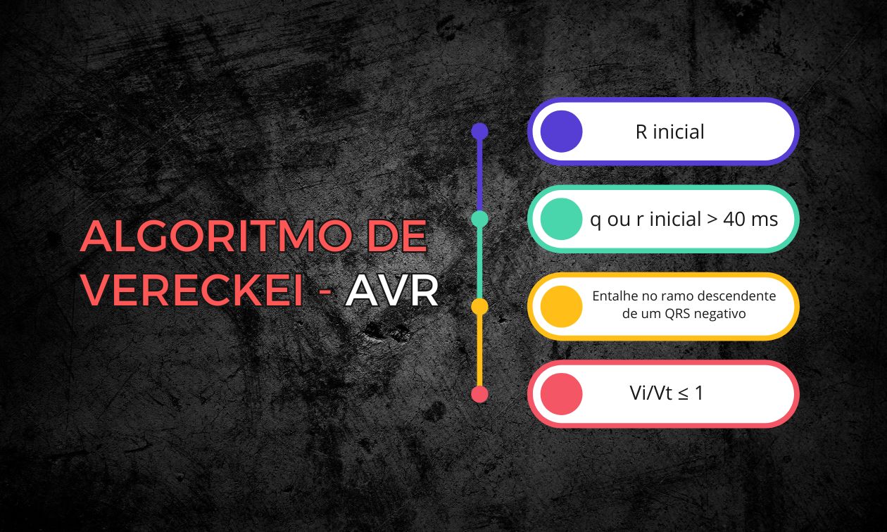 No momento, você está visualizando Como aplicar o algoritmo de Vereckei para diagnóstico das taquicardias de QRS largo