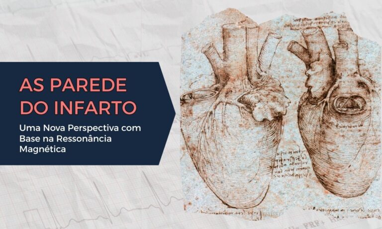 Leia mais sobre o artigo As Paredes do Infarto: Uma Nova Perspectiva com Base na Ressonância Magnética