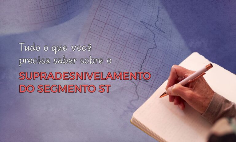 Leia mais sobre o artigo Tudo que Você Precisa Saber sobre o Supradesnivelamento do Segmento ST