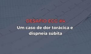 Leia mais sobre o artigo Desafio ECG #4: Um caso de dor torácica e dispneia súbita