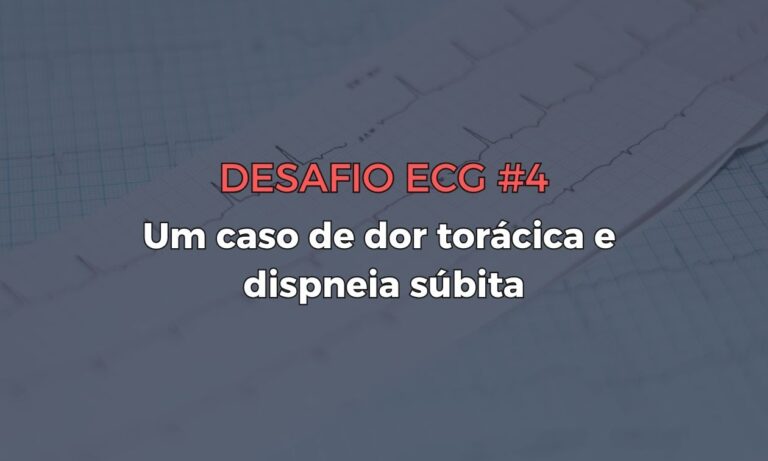 Leia mais sobre o artigo Desafio ECG #4: Um caso de dor torácica e dispneia súbita