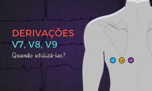 Leia mais sobre o artigo Derivações V7, V8 e V9: Quando utilizá-las?