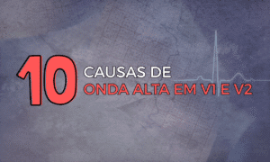 Leia mais sobre o artigo 10 Causas de Onda R Alta em V1 e V2