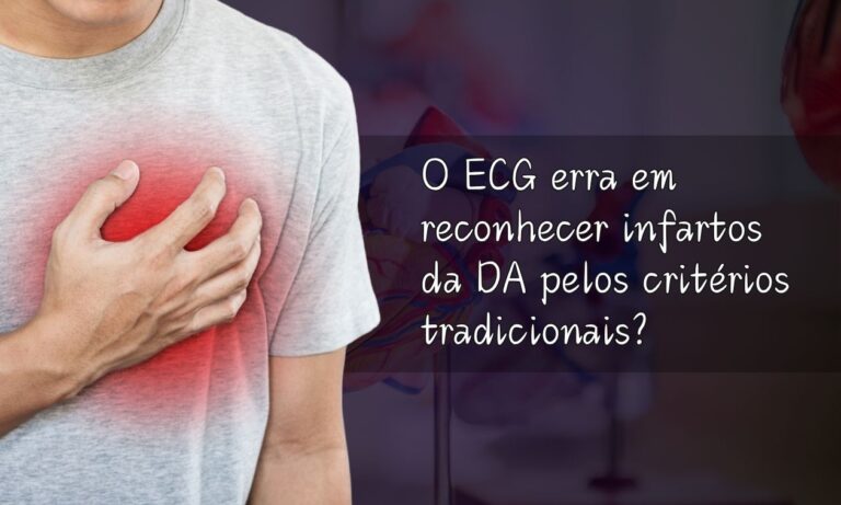 Leia mais sobre o artigo O ECG erra em pacientes com infarto de DA?