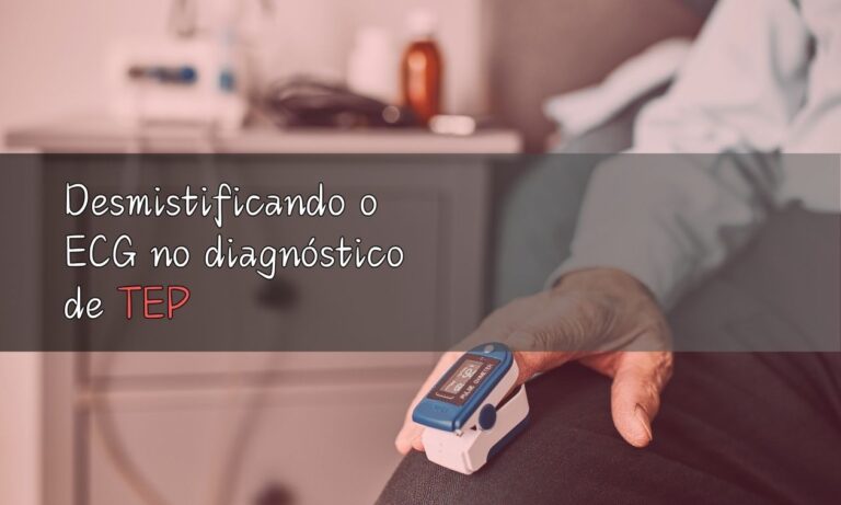 Leia mais sobre o artigo Desmistificando o ECG no diagnóstico de TEP