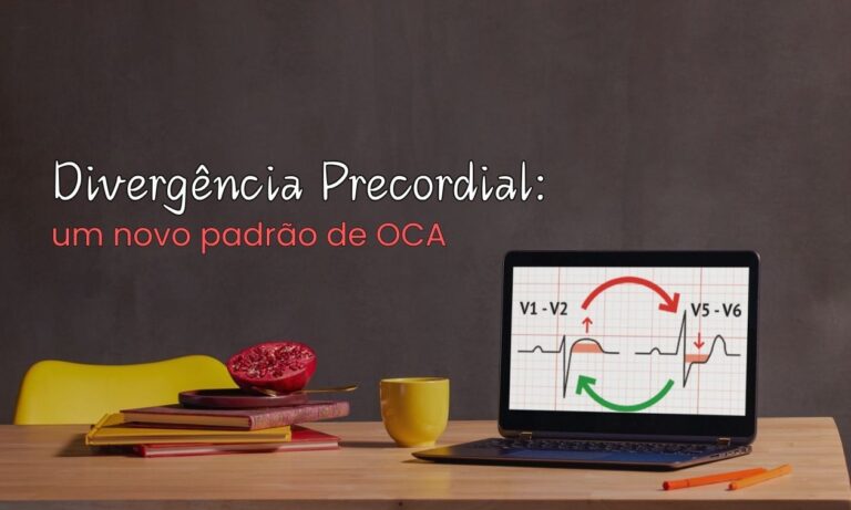 Leia mais sobre o artigo Divergência Precordial: um novo padrão de OCA