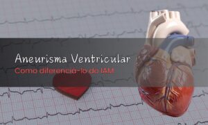Leia mais sobre o artigo Como Diferenciar Aneurisma Ventricular do IAM