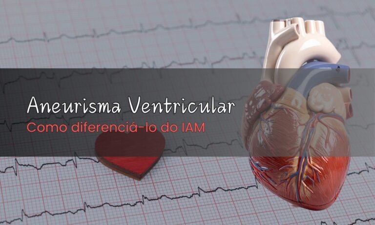Leia mais sobre o artigo Como Diferenciar Aneurisma Ventricular do IAM