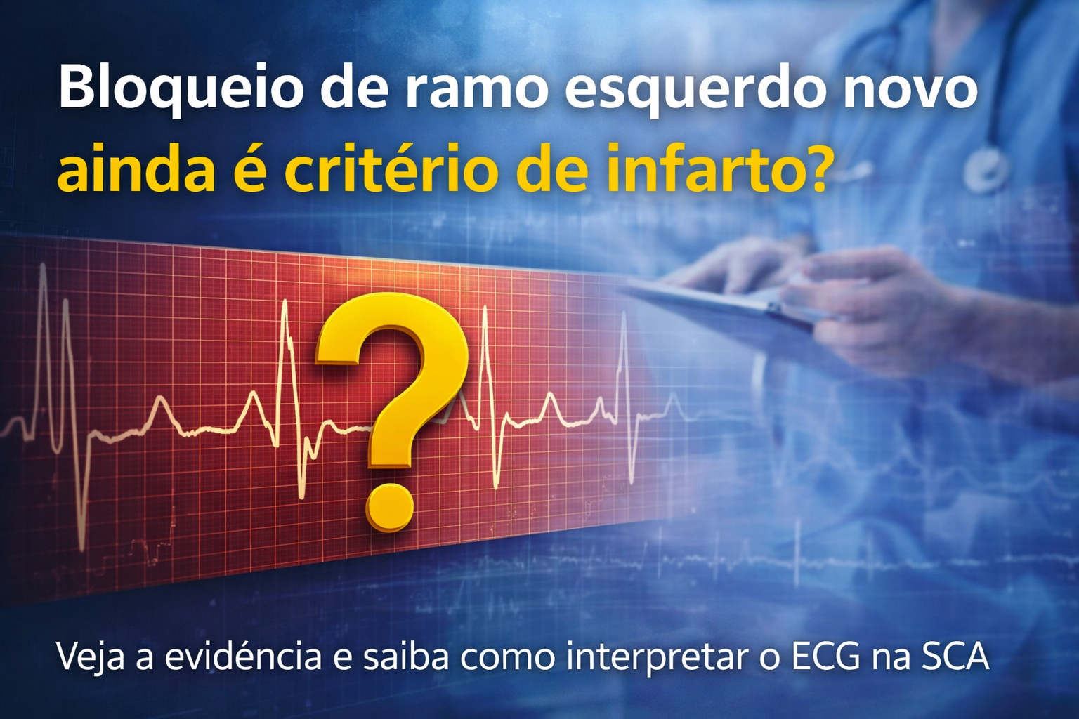 No momento, você está visualizando Bloqueio de ramo esquerdo novo: ainda é critério de infarto?